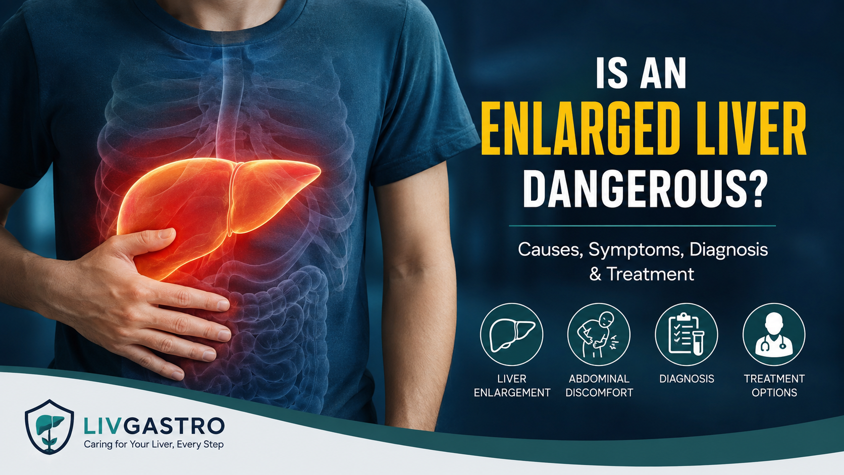 Is an Enlarged Liver Dangerous? Causes, Symptoms, Diagnosis & Treatment