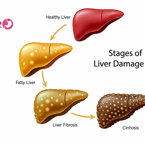 Medical illustration showing fatty liver disease with a doctor explaining liver health and treatment options.
