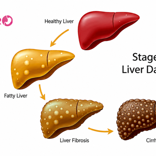 Medical illustration showing fatty liver disease with a doctor explaining liver health and treatment options.