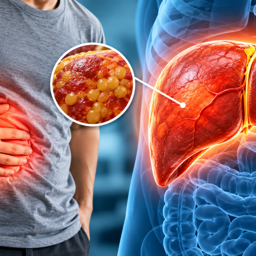 Is an Enlarged Liver Dangerous? Causes, Symptoms, Diagnosis & Treatment