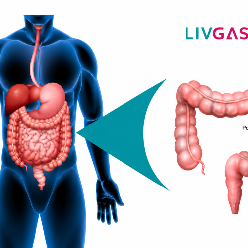 Expert gastro surgeon performing a colonoscopy procedure for safe and effective polyp removal